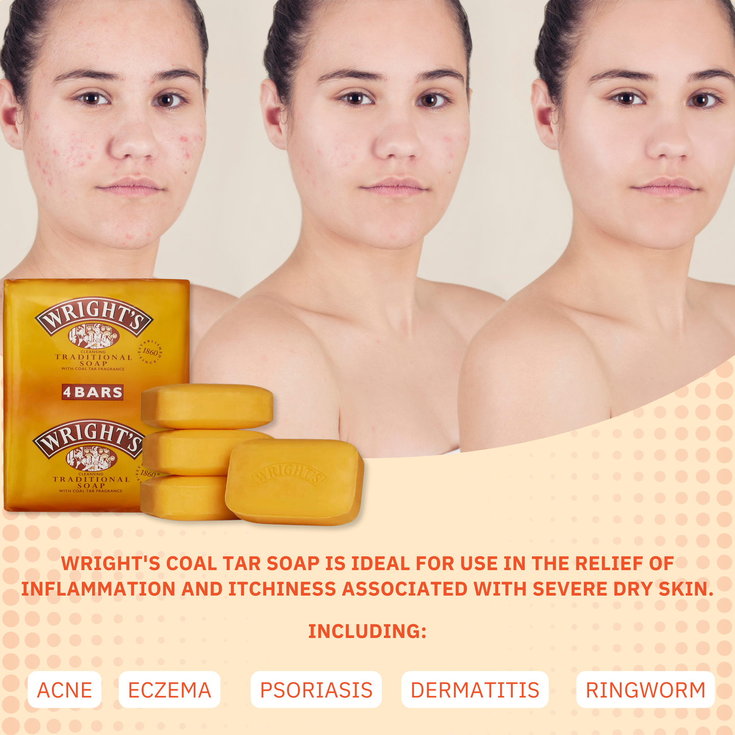 Wrights Coal Tar Soap 125g Multipack + Soap Dish – Antibacterial, Travel-Ready